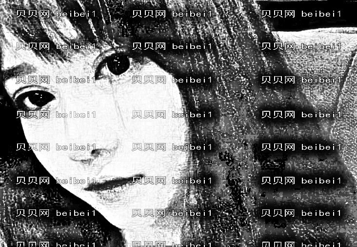 中日友好医院庄力医生做双眼皮怎么样?收费贵吗?附