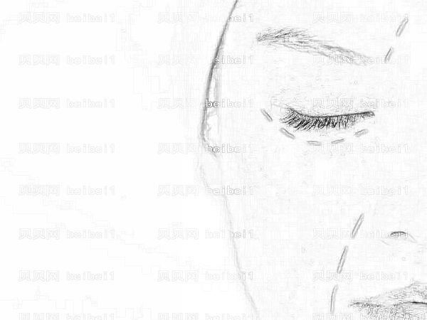 新疆人民医院李朝阳做眼部手术技术好不好？收费高吗？