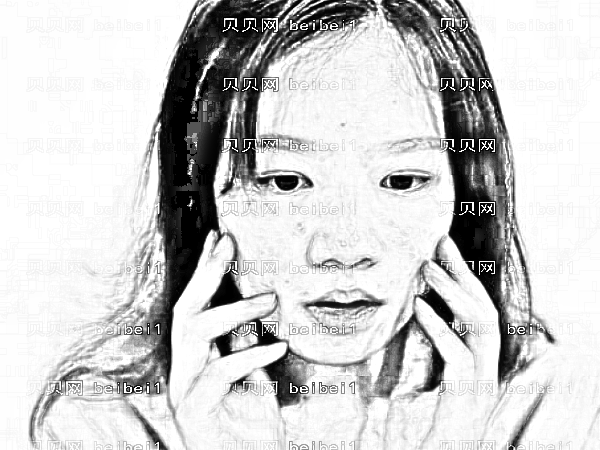 上海长征医院全切双眼皮做得怎么样?林子豪做双眼皮多少钱?