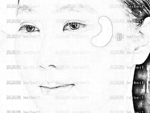 济南中心医院做双眼皮怎么样?郭丹凤医生做眼睛口碑好不好?
