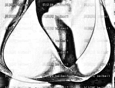 北京八大处做乳房下垂矫正怎么样？穆大力和刘春军好吗？医学科学院整形外科医院