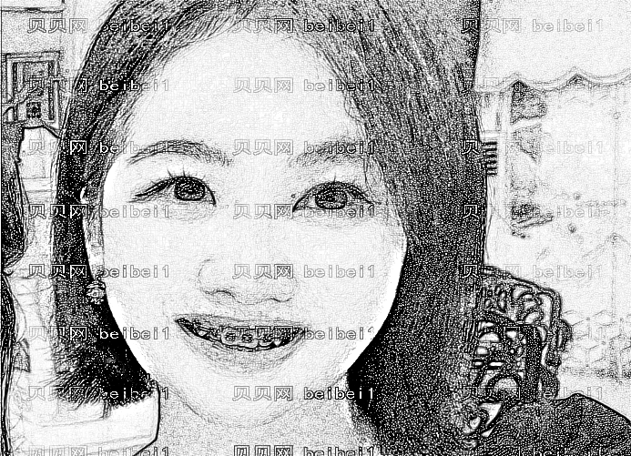 长春超龙牙博士口腔做牙齿矫正多少钱?,长春正畸价格!