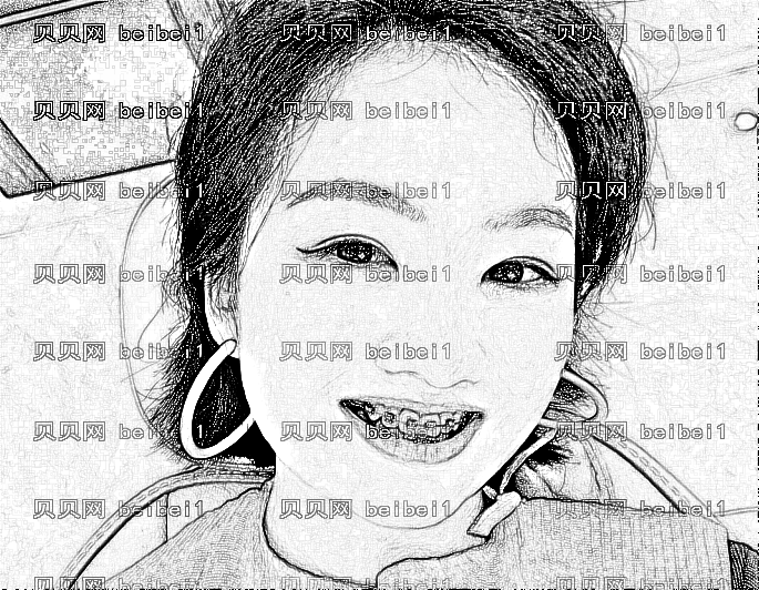 长春超龙牙博士口腔做牙齿矫正多少钱?,长春正畸价格!