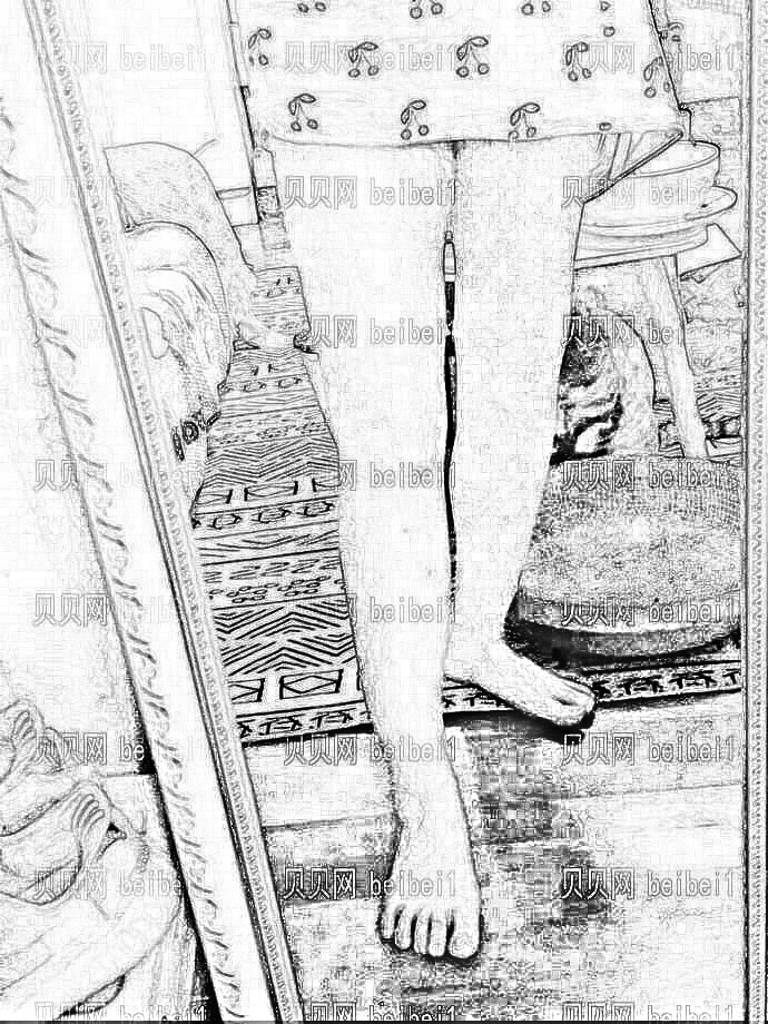 北京东方和谐吸脂多少钱?较新大小腿吸脂·介绍片分享