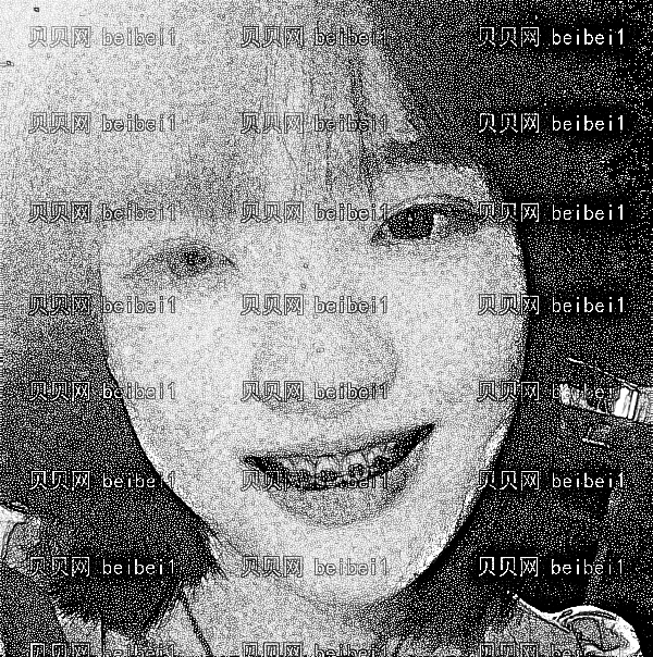北京矫正牙齿去哪家医院好?北京正畸在线收费表一览