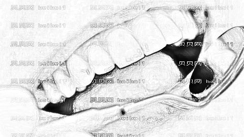 芜湖一院牙齿矫正怎么样?,凸嘴矫正介绍及