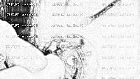 华西附二院去疤痕好不好?去疤痕手术介绍及内部