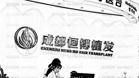 成都恒博植发怎么样?哪个医生技术好