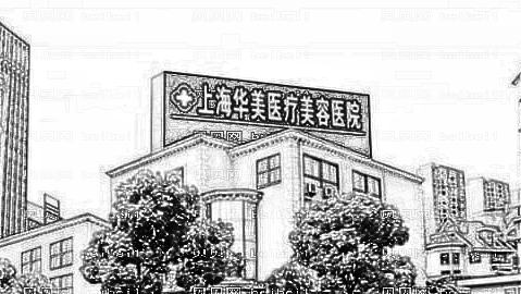 上海华美整形医院做热玛吉抗衰除皱怎么样?好吗【有没有介绍】