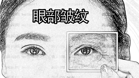 俞世放做双眼皮怎么样?俞世放,做双眼皮介绍及