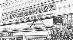 中瀚做眼睛怎么样?中瀚做眼睛介绍,整形报价表公布