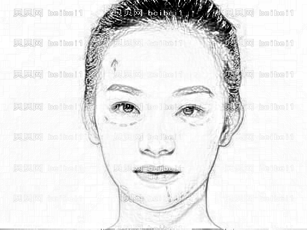 佛山祛斑哪家医院专业?佛山美莱做激光美肤祛斑多少钱【】?