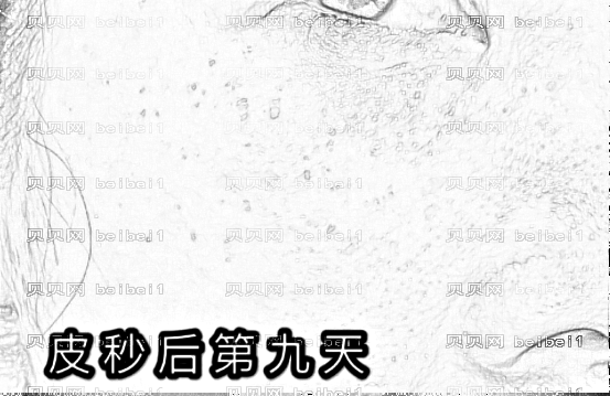 杭州瑞丽郭文丽医生做祛斑除皱靠谱吗?郭文丽激光美肤祛斑多少钱?