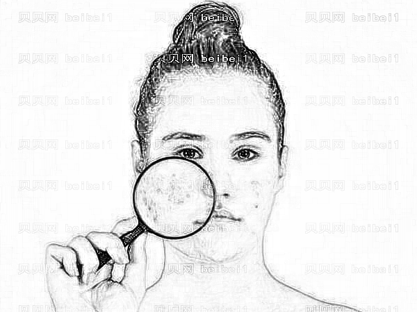 常州美贝尔杨天志做激光祛斑怎么样?大概多少钱【】