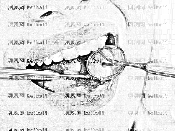 东营哪个医院矫正牙齿价格便宜？维恩口腔做牙齿矫正多少钱？