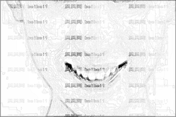 ,北京大学深圳医院正颌手术怎么样?正颌手术