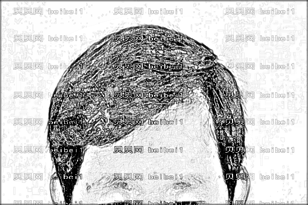 厦门市第一医院植发?植发医生哪个好