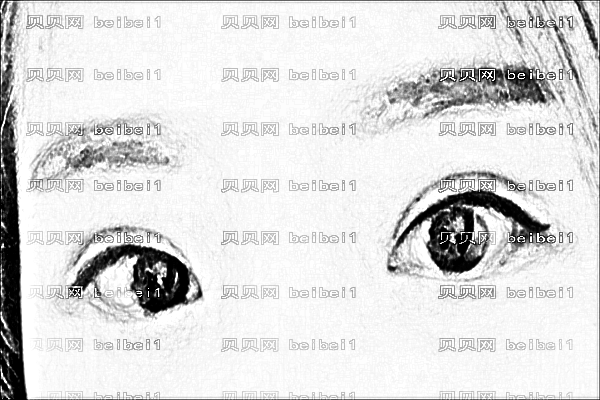 ,大连医大附属一院做双眼皮怎么样