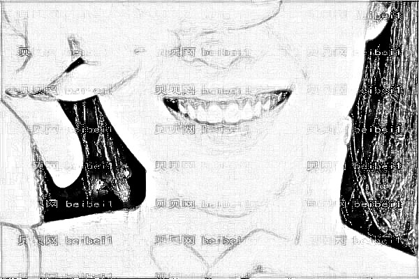 ,牙齿矫正_宁波市一院牙齿矫正怎么样