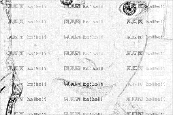 ,激光嫩肤_大连医大附属一院激光嫩肤怎么样