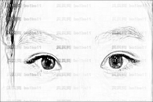 徐永医生做眼睛技术好不好?徐永全切双眼皮多少钱?