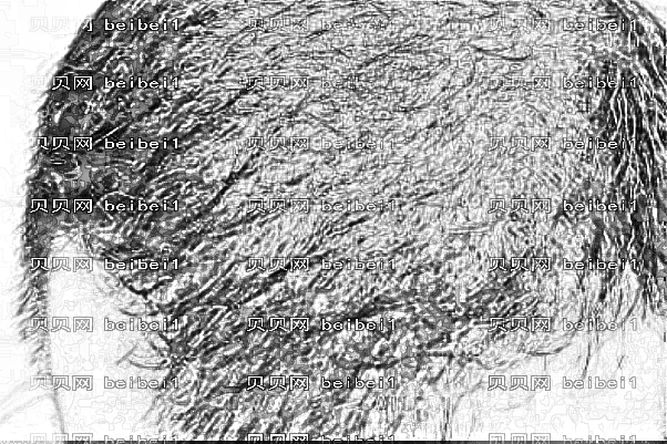 南京新生植发怎么样?多少钱?【】