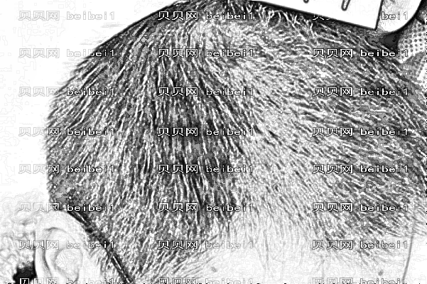南京新生毛发种植多少钱?哪个医生专业?【技术、口碑】