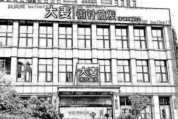 成都大麦微针植发多少钱?怎么样?好吗?