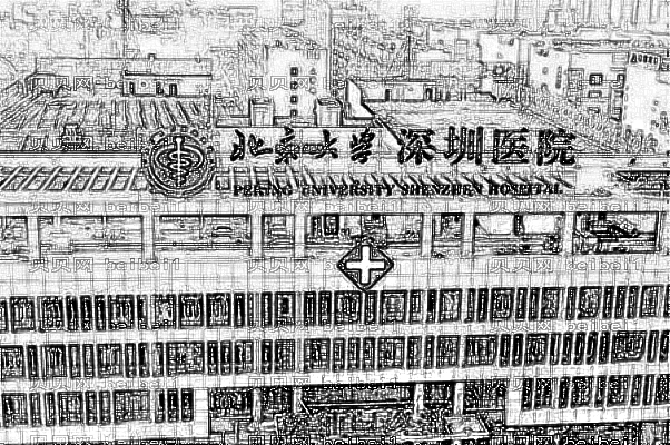 北京大学深圳医院,植发怎么样?FUT植发