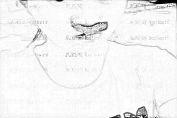 ,北京大学深圳医院打玻尿酸怎么样?打玻尿酸