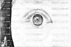 济南哪些医生双眼皮失败修复技术好？苗春玲做眼部修复多少钱？