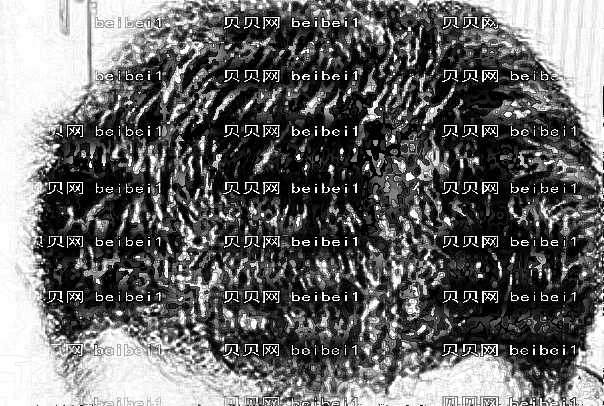 珠海韩妃植发价格一般多少钱?