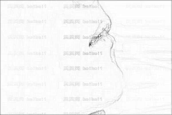 广州中山医一院削骨怎么样