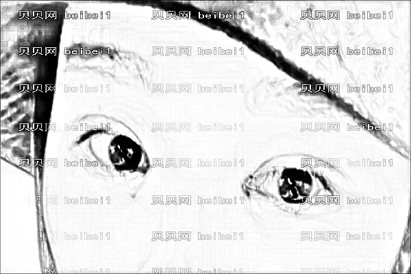 柳松青做全切开双眼皮怎么样?揭秘深圳广和医院双眼皮