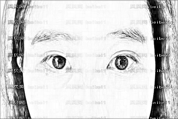 柳松青做全切开双眼皮怎么样?揭秘深圳广和医院双眼皮