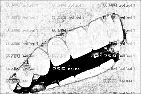 泉州东街一院牙齿矫正_牙齿矫正有几种方式