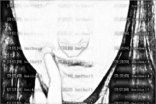 深圳晨曦朱春艳做鼻部手术整形怎么样?大概费用多少钱?