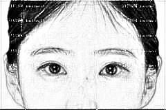 深圳蒳美迩去眼袋去黑眼圈怎么样,大概多少钱？
