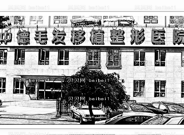 北京中德植发怎么样?多少钱?【】