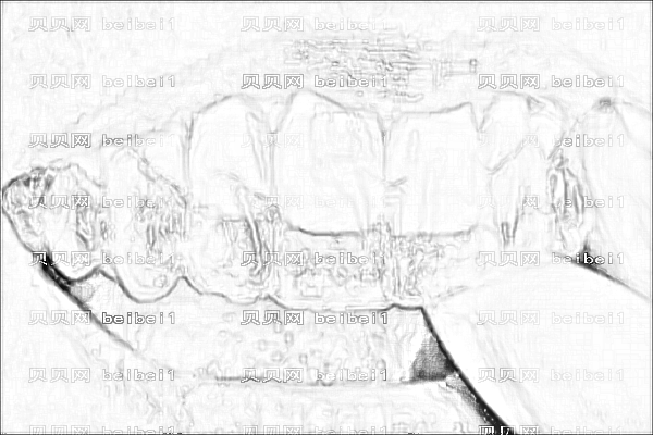 ,合肥一院西区牙齿矫正【附牙齿矫正介绍】