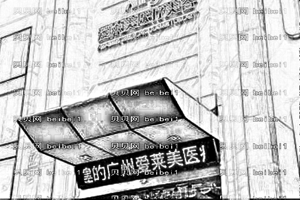 广州爱莱美刘志刚隆鼻失败修复技术靠谱吗?收费大概多少钱?