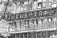 深圳军科刘月更做埋线提升技术好不好？埋线抗衰一般多少钱？