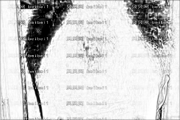 淮安市第一人民植发怎么样