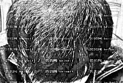 六安一院植发?附植发介绍