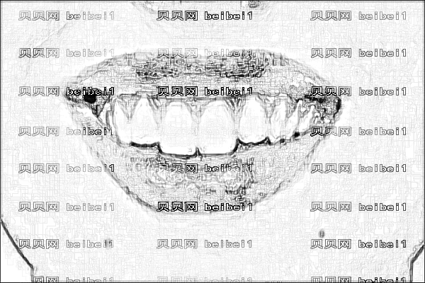 张家港一院牙齿矫正多少钱【附牙齿矫正介绍】