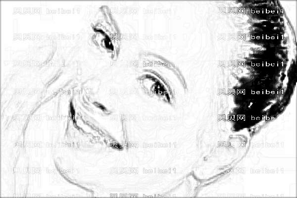 ,光子嫩肤公开_肇庆新一院光子嫩肤怎么样