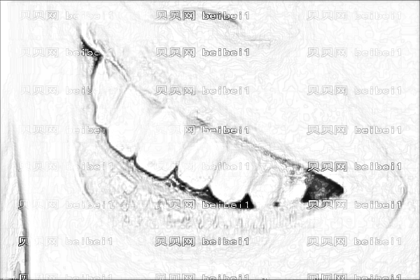 ,南阳市一院种植牙怎么样【附种植牙介绍】