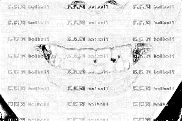 佛山市市一院植牙哪个医生好_怎么样