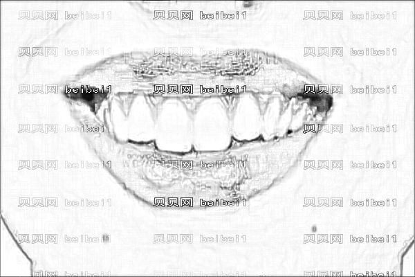 淮阴一院牙齿矫正曝光_怎么样