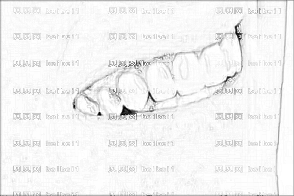 ,哈医大一院种植牙?种植牙医生哪个好
